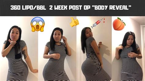 BBL + LIPO! .